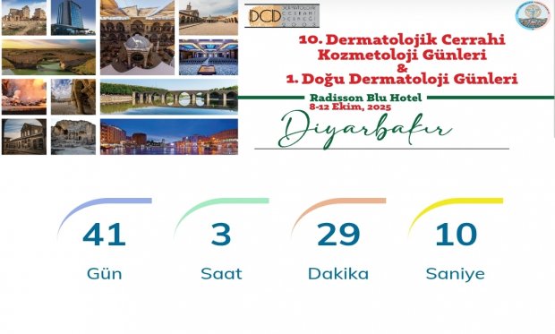 Kongremize Sayılı Günler Kaldı